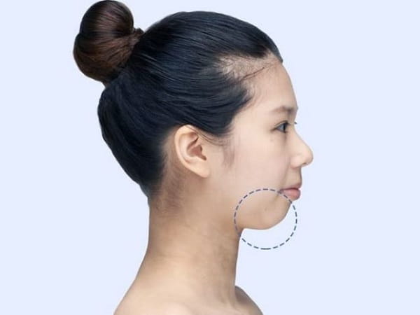 Tướng phụ nữ cằm lẹm – đường tình duyên và hậu vận