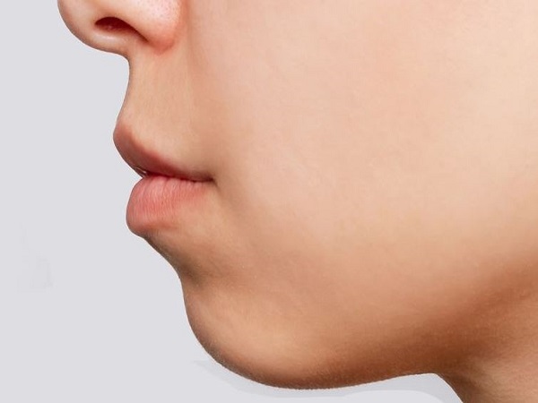 Nhận diện cằm lẹm qua đặc điểm khuôn mặt